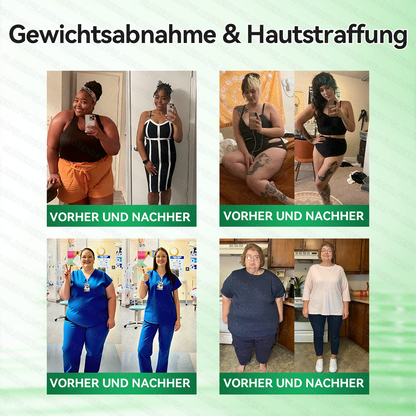 𝐎𝐟𝐟𝐢𝐳𝐢𝐞𝐥𝐥𝐞𝐫 𝐒𝐡𝐨𝐩 | 💁‍♀️💁‍♀️𝑮𝑳𝑶𝐑𝐄𝐍𝐃𝘼®𝙈𝙤𝙧𝙞𝙣𝗴𝗮 · 𝗕𝗲𝗿𝗯𝗲𝗿𝒊𝒏 × 𝑵𝘼𝘿+ 10-𝙞𝙣-𝟏 𝐅𝐨𝐫𝐭𝐬𝐜𝐡𝐫𝐢𝐭𝐭𝐥𝐢𝐜𝐡𝐞𝐬 𝐍𝐚𝐧𝐨-𝐌𝐢𝐤𝐫𝐨𝐧𝐚𝐝𝐞𝐥-𝐏𝐟𝐚𝐬𝐭𝐞𝐫(𝐍𝐮𝐫 𝐞𝐢𝐧𝐦𝐚𝐥 𝐭ä𝐠𝐥𝐢𝐜𝐡, 𝐬𝐢𝐜𝐡𝐭𝐛𝐚𝐫𝐞 𝐕𝐞𝐫ä𝐧𝐝𝐞𝐫𝐮𝐧𝐠𝐞𝐧 𝐢𝐧 𝟕 𝐓𝐚𝐠𝐞𝐧)✅ 𝐅ü𝐫 𝐅𝐞𝐭𝐭𝐥𝐞𝐢𝐛𝐢𝐠𝐤𝐞𝐢𝐭, 𝐇𝐚𝐮𝐭𝐬𝐭𝐫𝐚𝐟𝐟𝐮𝐧𝐠, 𝐃𝐢𝐚𝐛𝐞𝐭𝐞𝐬, 𝐒𝐜𝐡𝐥𝐚𝐟𝐚𝐩𝐧𝐨𝐞, 𝐆𝐞𝐥𝐞𝐧𝐤𝐩𝐫𝐨𝐛𝐥𝐞𝐦𝐞 𝐮𝐧𝐝 𝐦𝐞𝐡𝐫 🎁